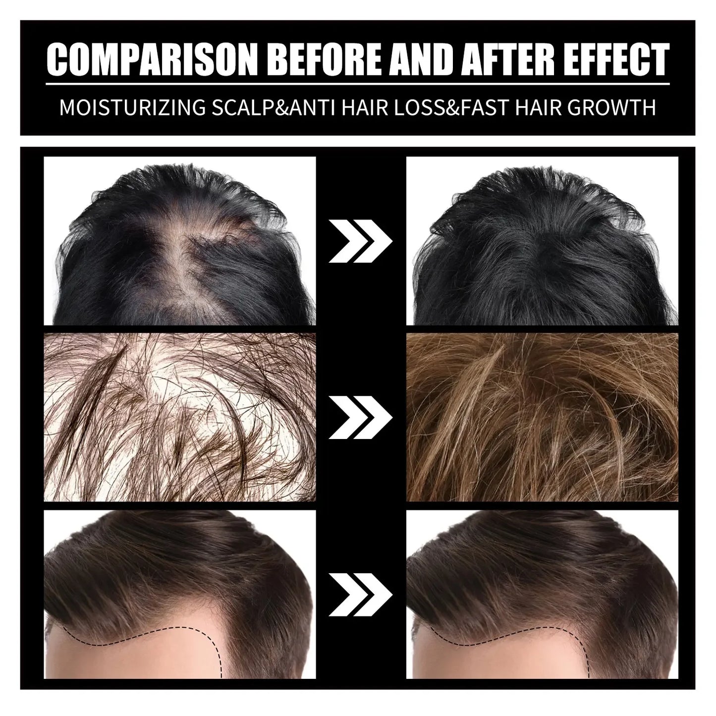 Liquid Biotin & Collagen Hair Growth Drops, Supplement for Glowing Skin, Support Healthy Hair Growth