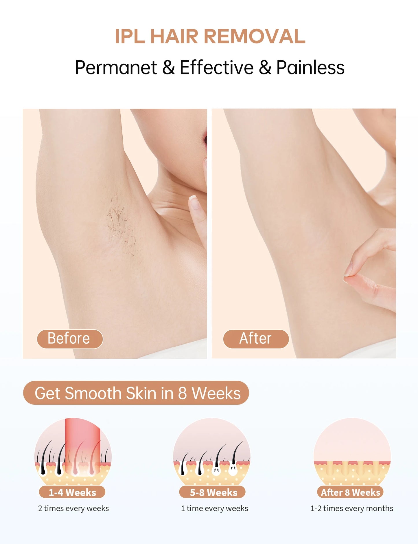Laser Hair Removal At Home 999900+ Flashes Painless Pulsed Light Epilator HR/RA/SC 3 in 1 Whole Body