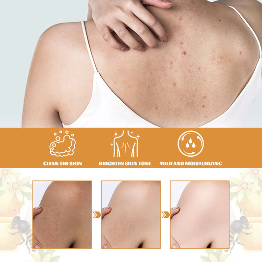 Honey Shower Gels, Refreshing, Moisturizing Body Wash, Smooth, Gentle Cleansing, Firming, Skin Exfoliating, Brightening Shower Lotion