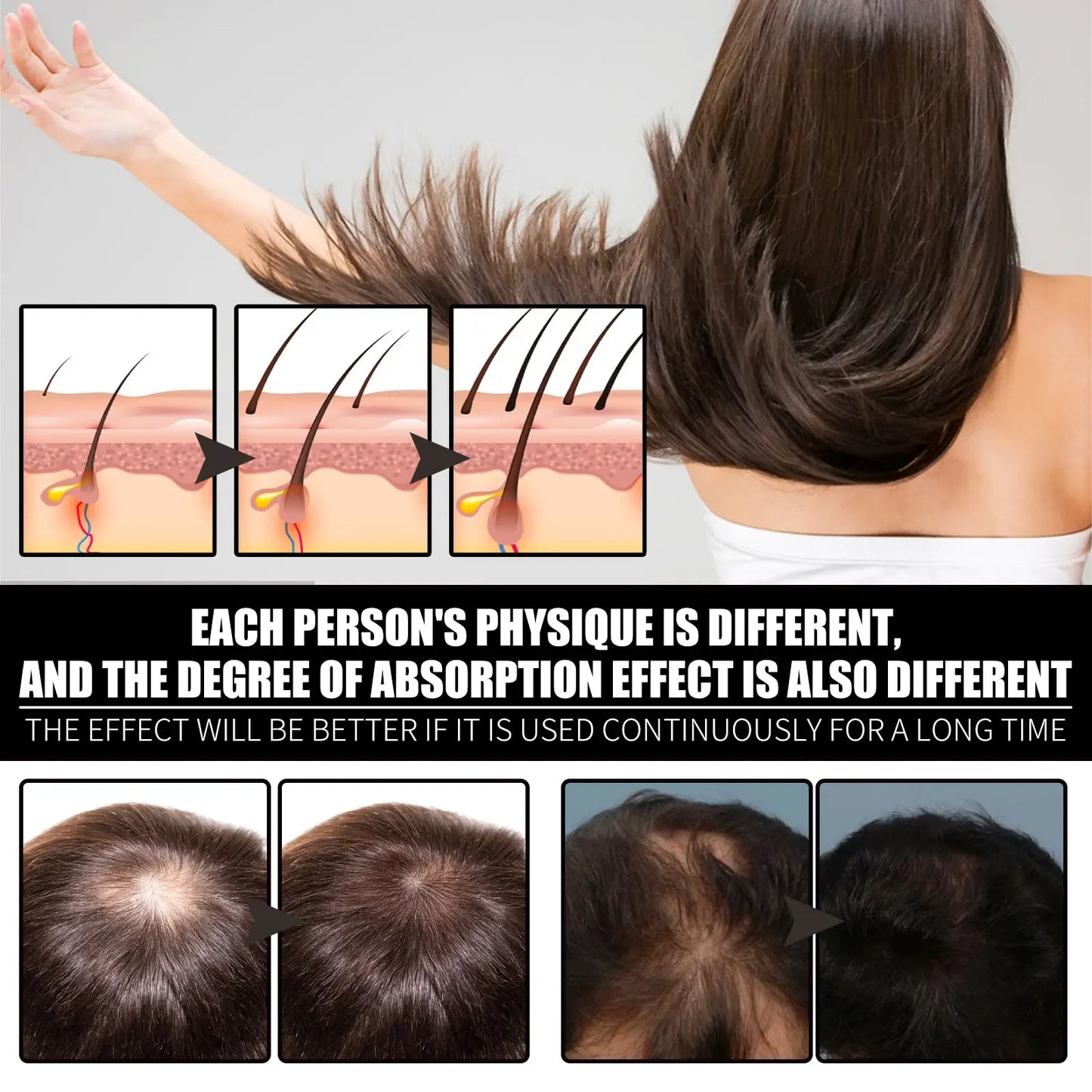 Liquid Biotin & Collagen Hair Growth Drops, Supplement for Glowing Skin, Support Healthy Hair Growth