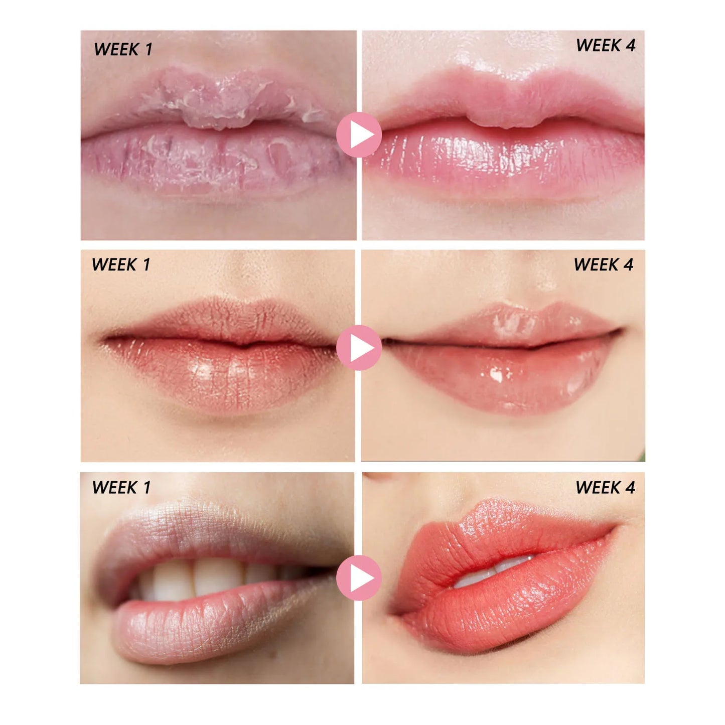 Pink Lip Scrub, Exfoliator, Dead Skin Removal, Lightening, Fade Lip Lines, Moisturizing, Makeup Lip Care
