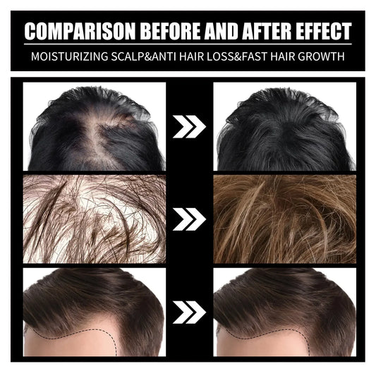 Liquid Biotin & Collagen Hair Growth Drops, Supplement for Glowing Skin, Support Healthy Hair Growth