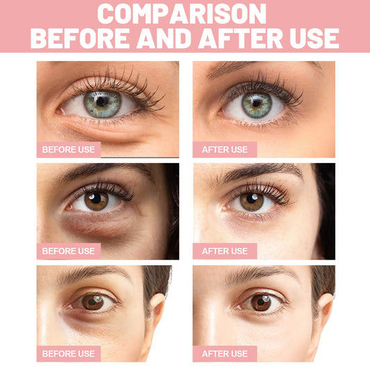 60pcs Rose Eye Mask Fades Fine Lines, Eye Bags, Dark Circles, Moisturizing, Firming Eye Patch, Eye Mask